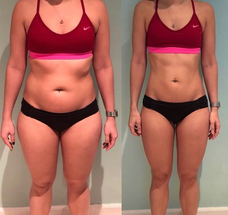 Antes e depois: -15 kg de gordura